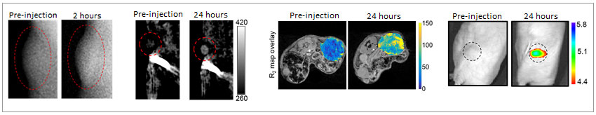 NAMIL: Breast cancer detection with four modalities and a single contrast agent graphic